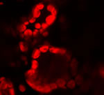 Confocal fluoursecnce microscope image of chloroplasts in Cytoplasmic hybrids of tobacco and h.niger